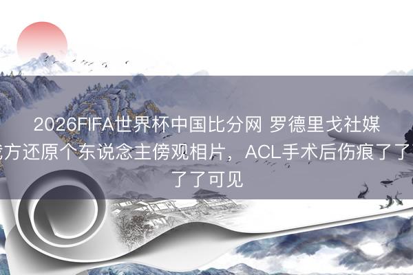 2026FIFA世界杯中国比分网 罗德里戈社媒晒我方还原个东说念主傍观相片,ACL手术后伤痕了了可见